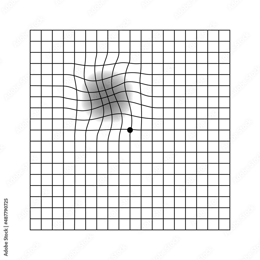 Amsler Eye Scotoma Test Grid Vector Printable Chart Retina Examination Grid With Dot In Centre Vision Control Eye Check Amsler Grid Test Stock Vector Adobe Stock Amsler Eye Scotoma Test Grid Vector Printable Chart Retina Examination Grid With Dot In Centre Vision Control Eye Check Amsler Grid Test Stock Vector Adobe Stock