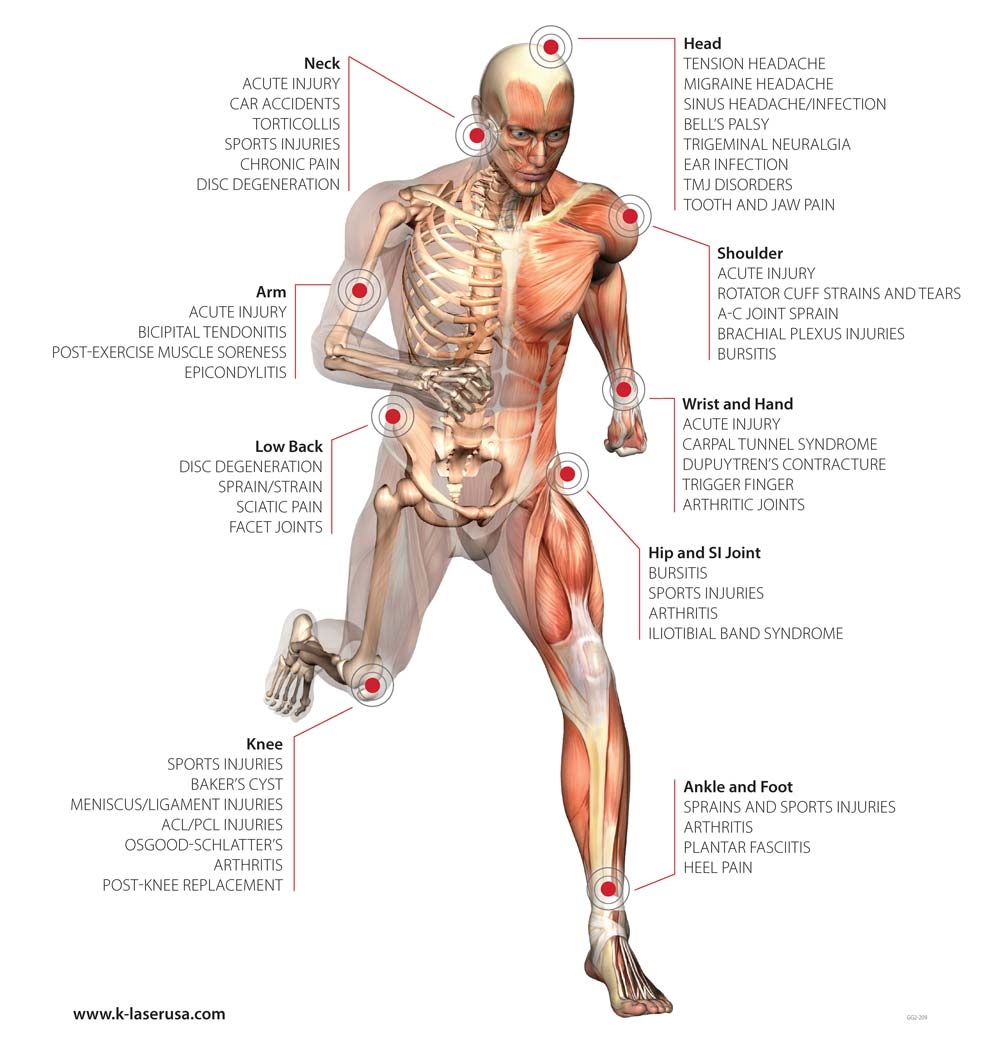 Myofascial Pain How Trigger Point Injection Can Help Dr Mehrtash Amini