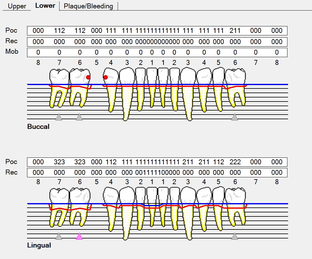 Free Printable Perio Chart Free Printable Perio Chart
