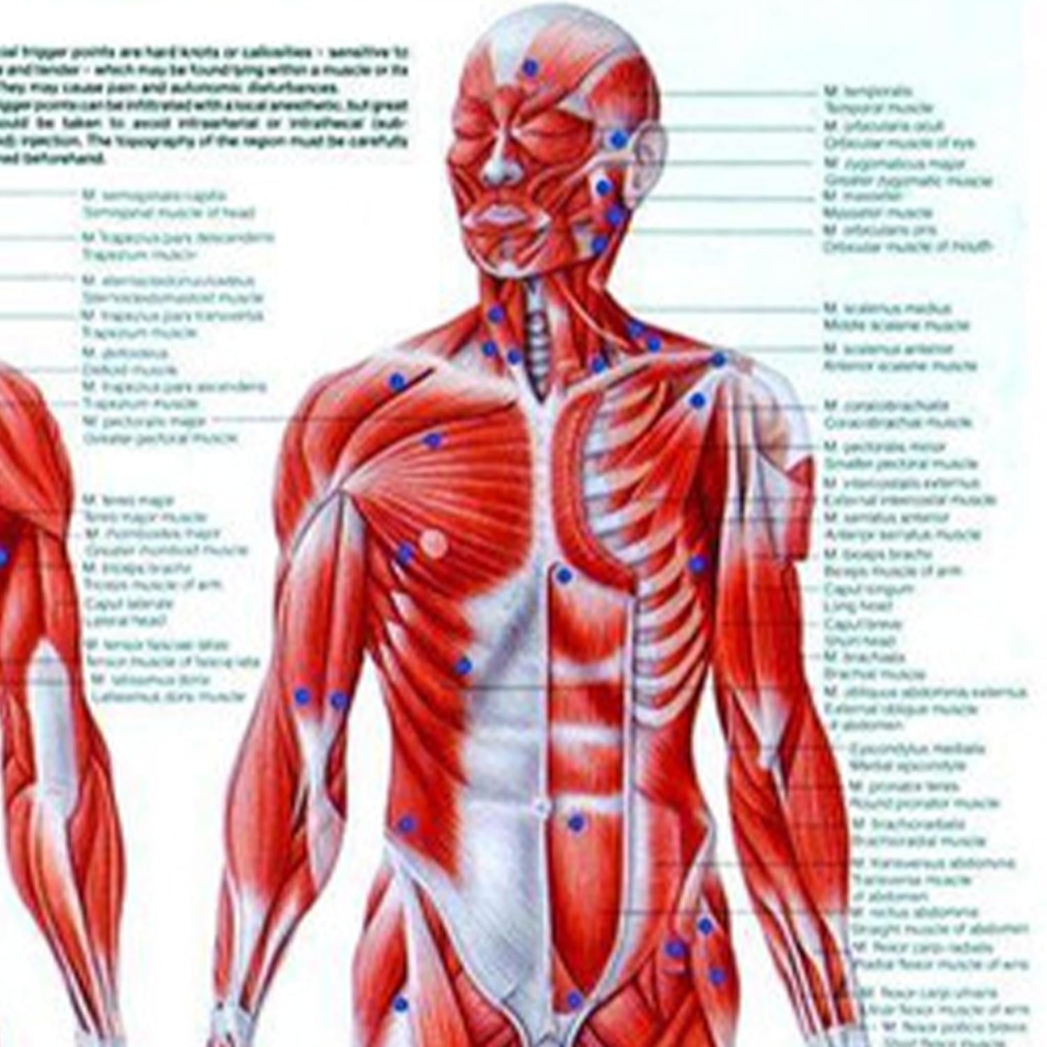 Free Printable Shoulder Trigger Points Chart