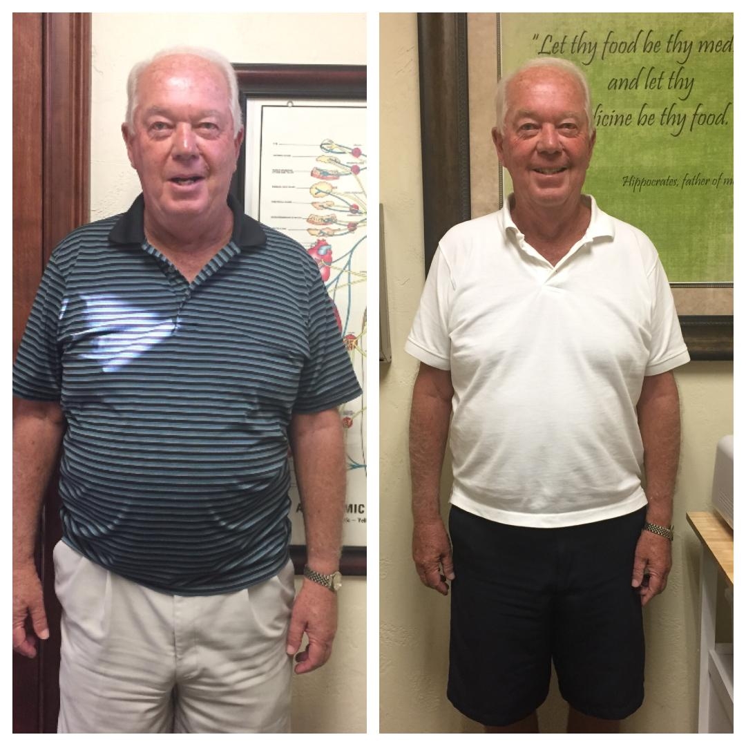 Weight Loss Solutions In The Villages Legacy Clinic Of Chiropractic